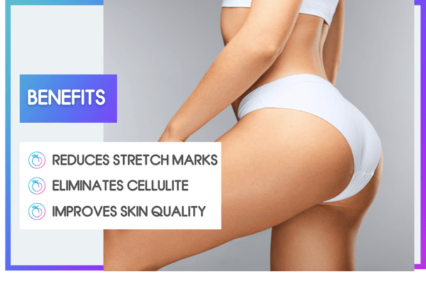 SculptraButtLift Email Banners