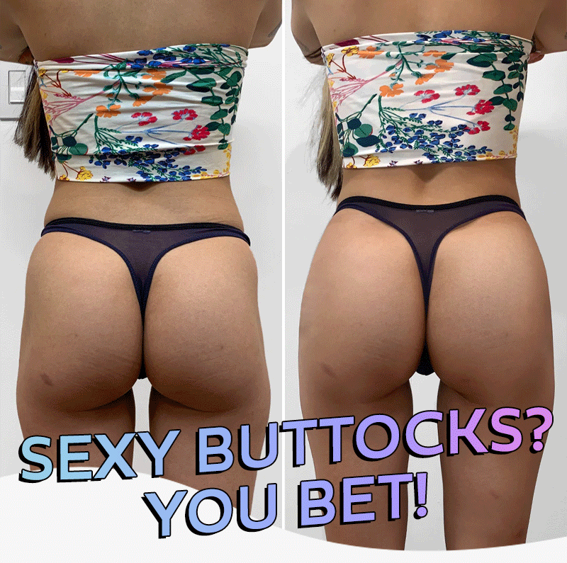 BeautyFix-BootyFix-Radiesse-Hubspot-Email-3-Hero